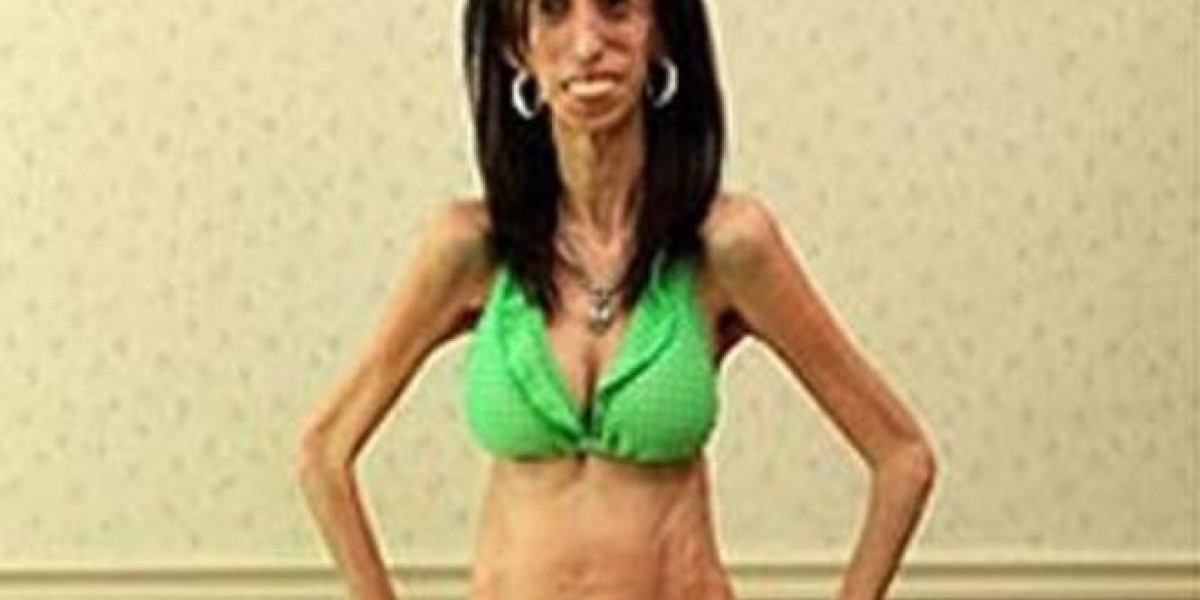 skinniest person in the world